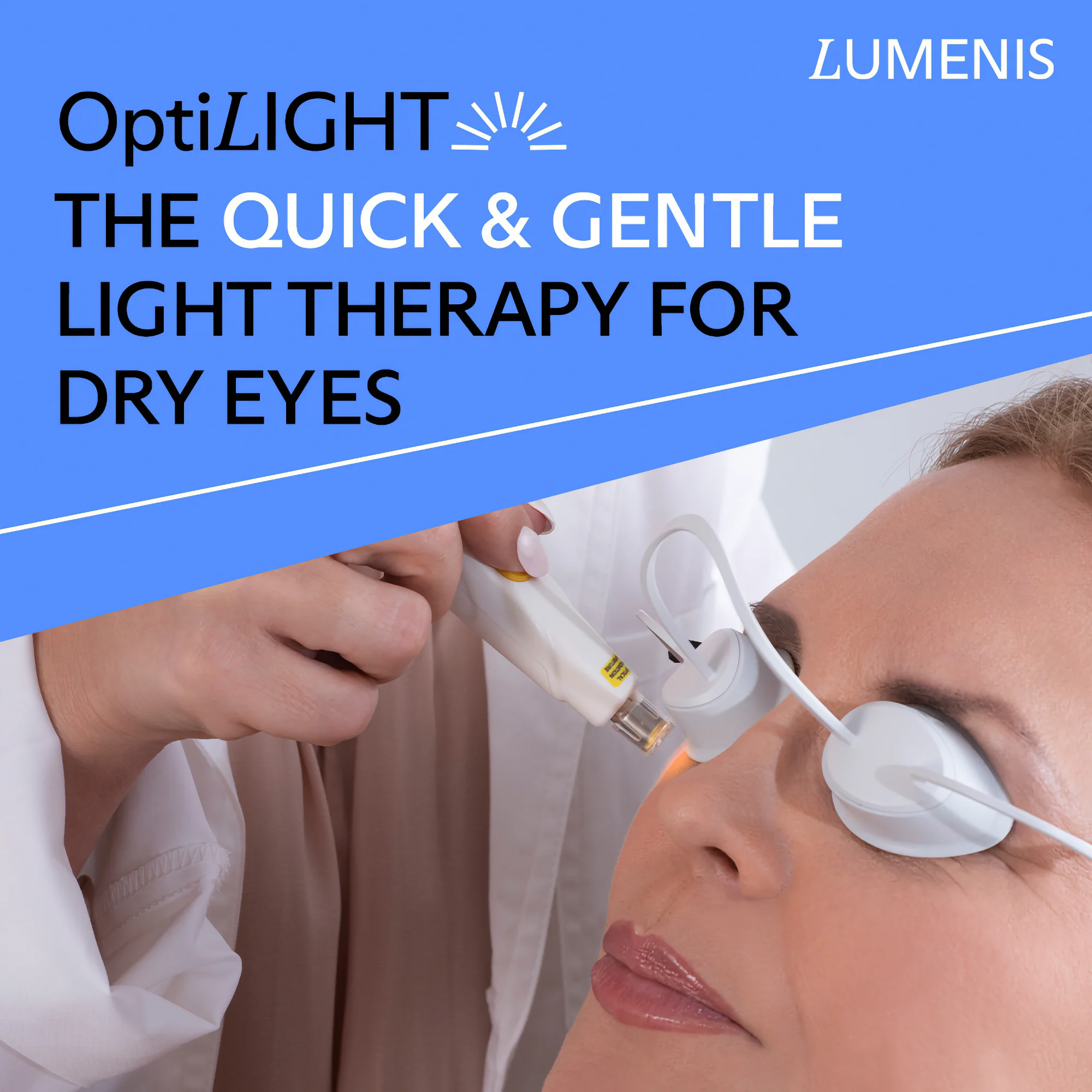 A woman wearing white eye protectors receives an OptiLIGHT treatment for dry eyes, administered by a professional holding the light therapy device.